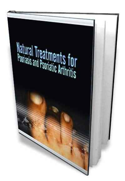 Natural Treatments For Psoriasis