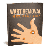 Wart Removal