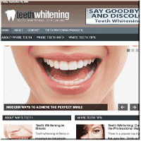Close-up of bright smile promoting teeth whitening.