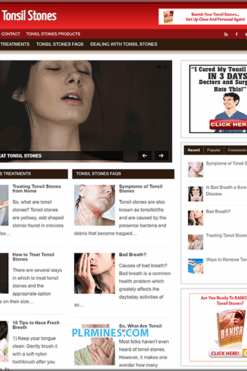 Tonsil Stones WordPress Website